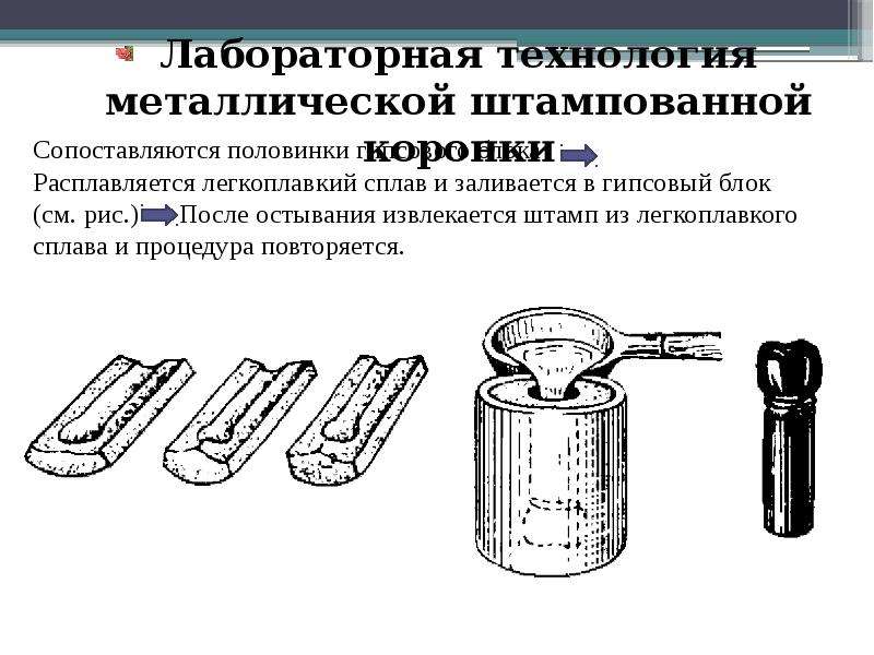 Изготовление штампованной. Штампик штампованной коронки. Штампованные коронки презентация. Виды штампованных коронок. Гипсовая форма для штампованной коронки.