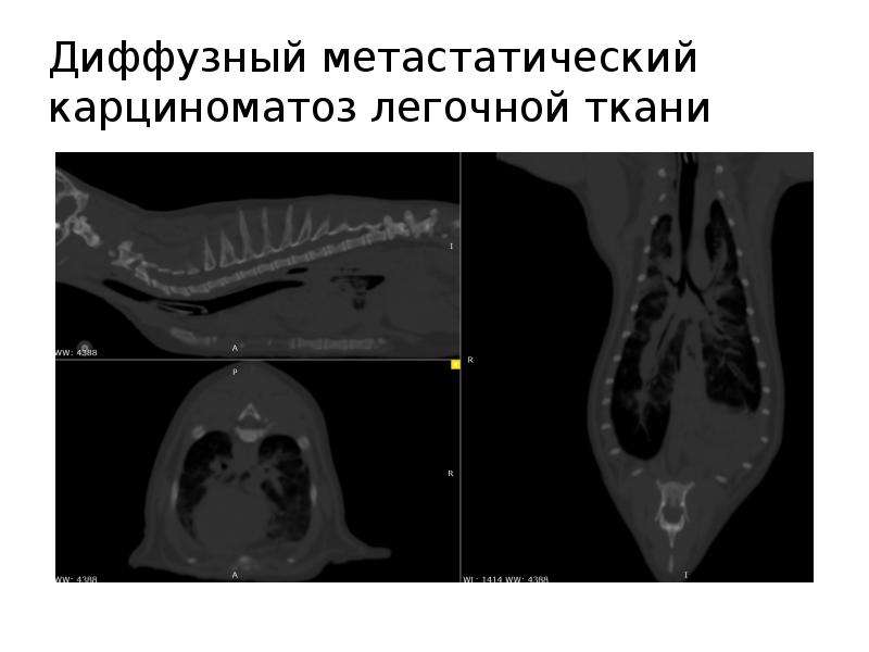 Карциноматоз. Вестибулярный синдром у кошек. Менингеальный карциноматоз. Вестибулярные бели Акушерство. Карциноматоз без динамики.