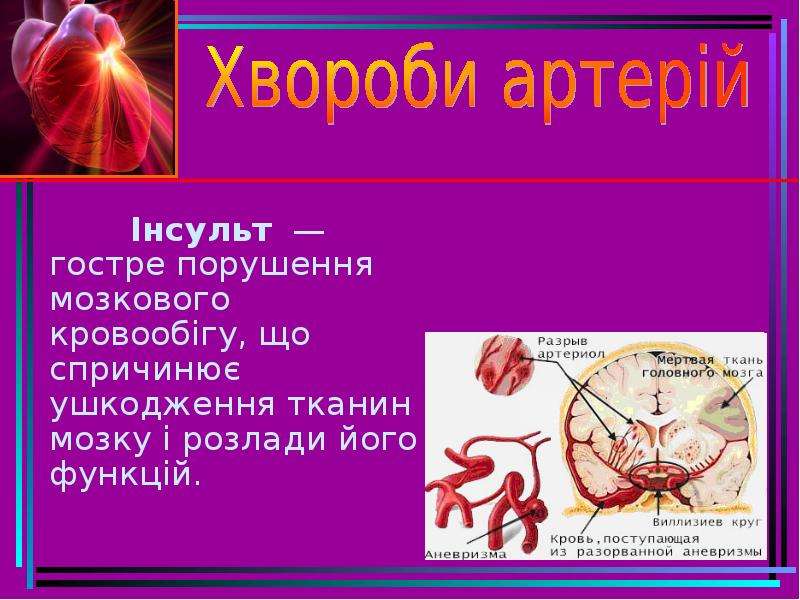 Биология 8 класс сердечно сосудистая система. Стадії хронічного порушення мозкового кровообігу.