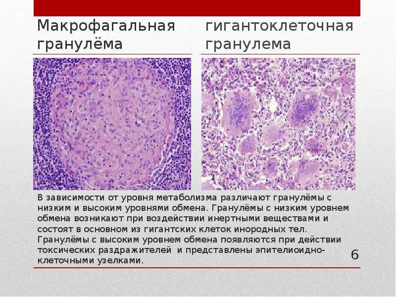 Формирование гранулемы - скачать презентацию