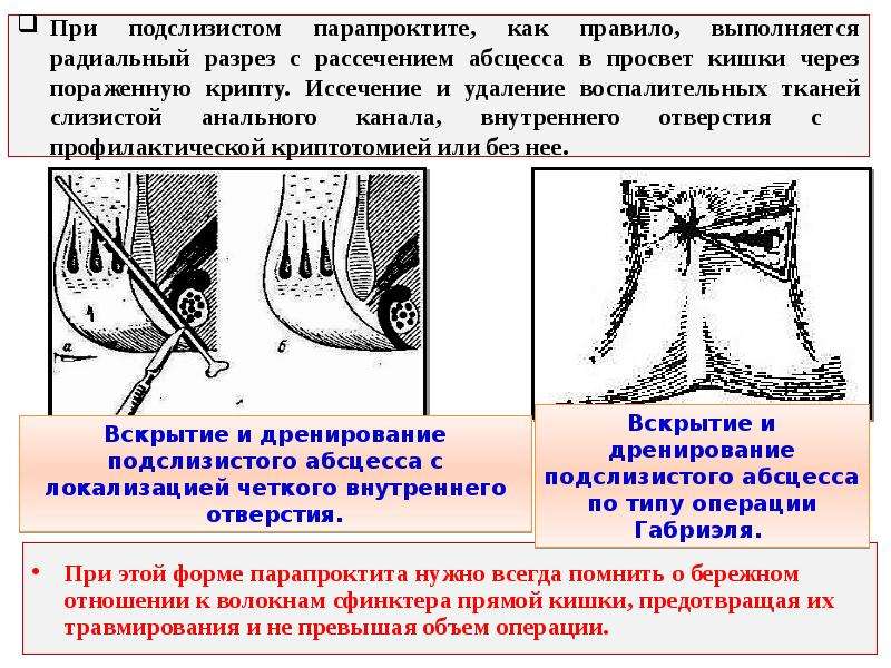 Парапроктит после операции фото