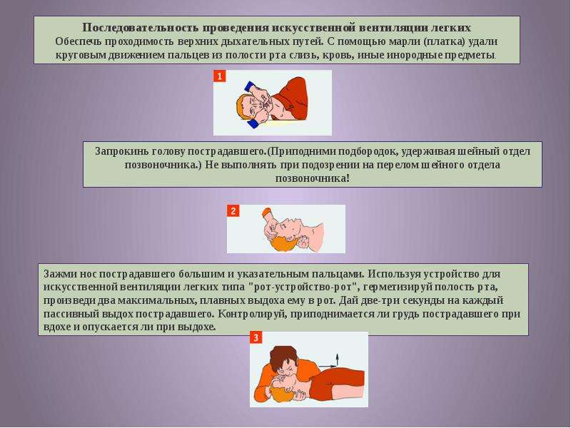 Первая помощь органов дыхания. Порядок оказания первой помощи при поражениях органов дыхания. Оказание первой помощи при повреждении дыхательных путей. План оказания первой помощи при поражении органов дыхания. Последовательность проведения искусственной вентиляции легких.