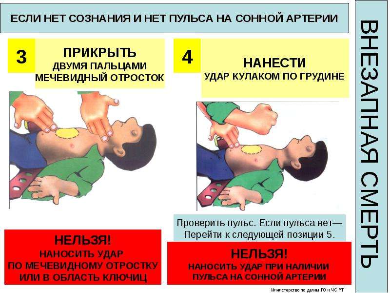 Схема оказания первой помощи на месте происшествия