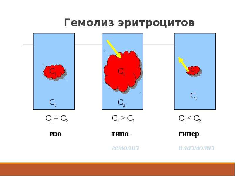 Гемолиз это. Гемолиз в гипотоническом растворе. Эритроцитарный гемолиз. Механизм гемолиза эритроцитов схема. Плазмолиз и гемолиз.