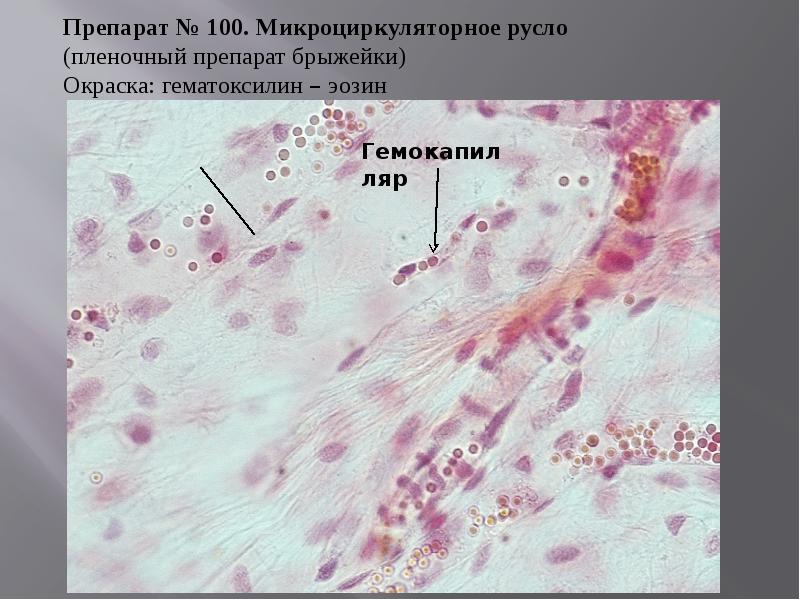Препарат система. Сосуды микроциркуляторного русла гистология. Сосуды микроциркуляторного русла препарат. Артериолы венулы капилляры препарат гистология. Сосуды микроциркуляторного русла гистология препарат.