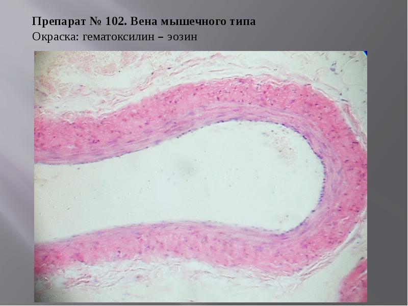 Рисунок артерии мышечного типа