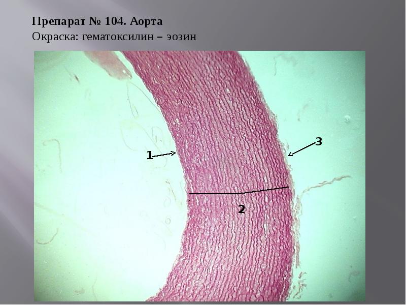 Артерии эластического типа гистология рисунок