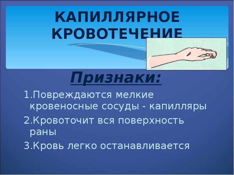 Капиллярное кровотечение первая помощь картинки