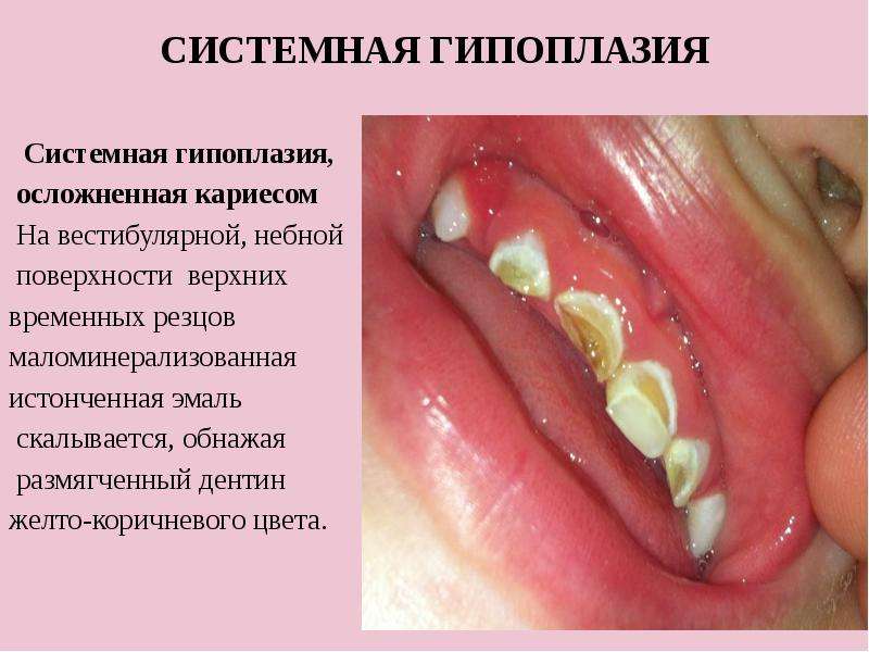 Составление плана обследования и лечения при заболеваниях твердых тканей зуба