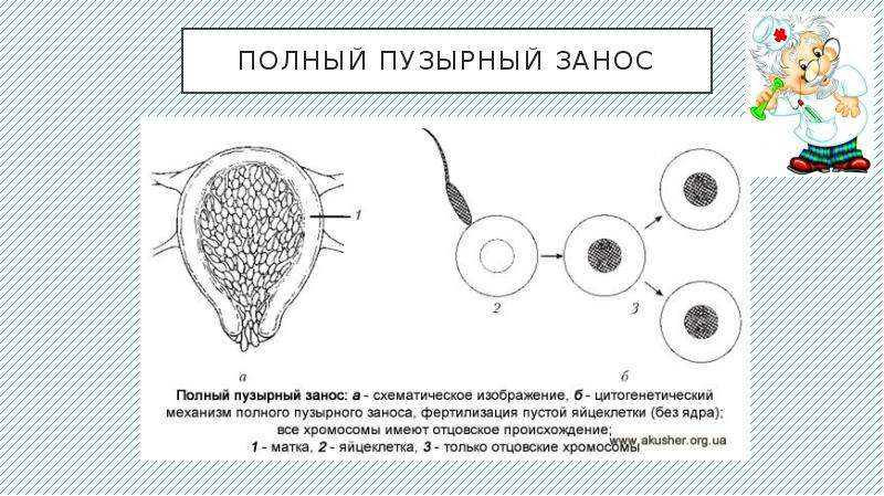 Пузырный занос презентация