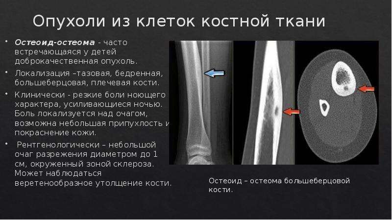 Лучевая диагностика костей презентация