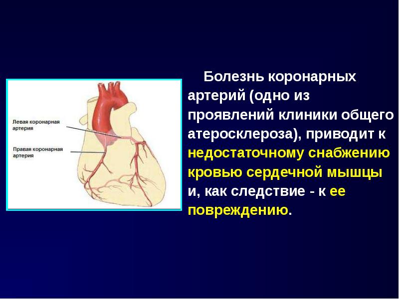 Болезнь коронарных артерий (одно из проявлений клиники общего атеросклероза), приводит к недостаточн