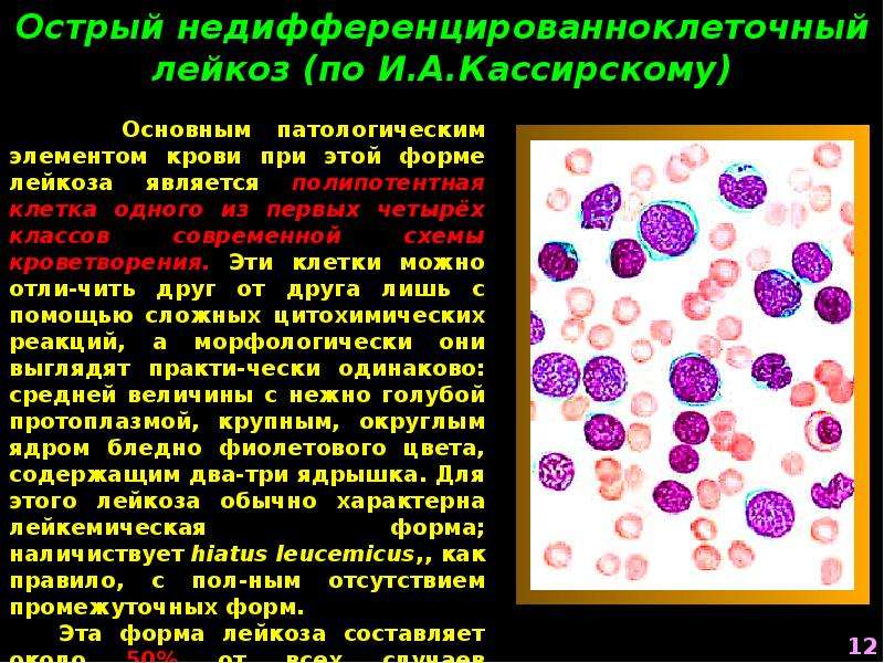 Эозинофильный лейкоцитоз. Лейкоцитозы, лейкозы и лейкопении.. Лейкоцитоз и лейкопения. Лейкопения в крови.