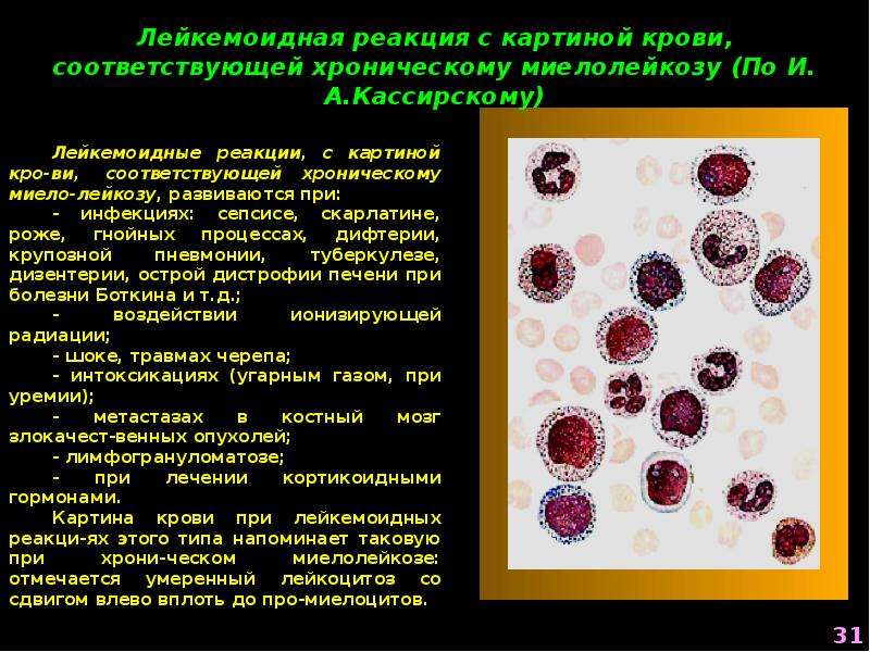 Лейкоцитоз наблюдается при. Инфекционный лейкоцитоз. Лейкоциты патофизиология. Лейкоцитоз в крови. Белая кровь патофизиология.