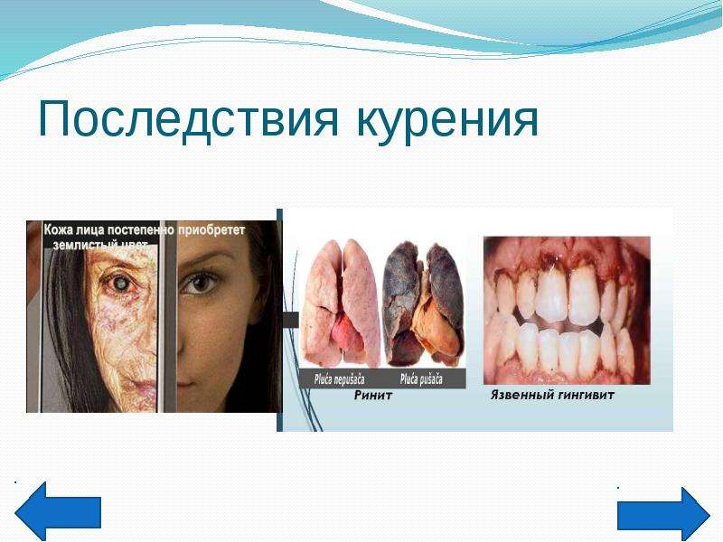 Вредные привычки и их последствия презентация