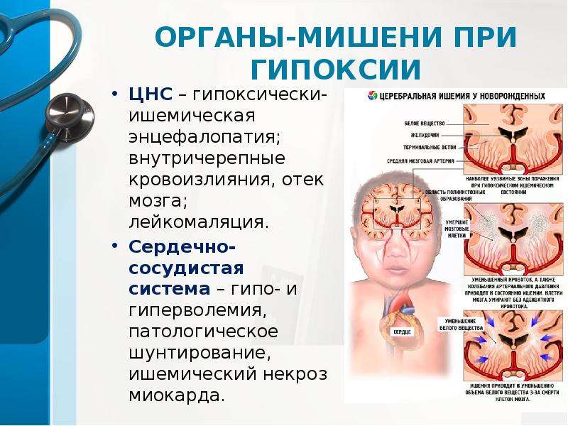 Причины гипоксии мозга. Гипоксия мозга симптомы у взрослого. Гипоксия головного мозга последствия. Гипоксия головного мозга у ребенка.