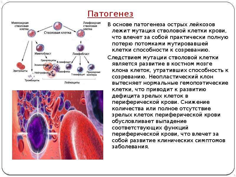 Острые лимфобластные лейкозы этиология патогенез клиническая картина