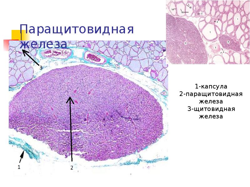 Паренхима щитовидной железы. Паращитовидная железа гистология препарат. Околощитовидная железа гистология препарат. Строение паращитовидной железы гистология. Околощитовидная железа строение гистология.