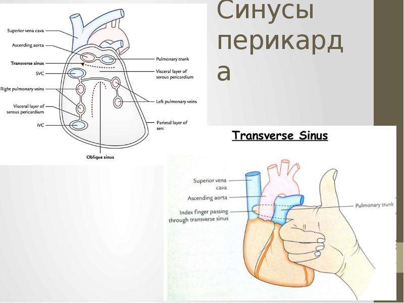 Передний нижний синус перикарда. Косая пазуха перикарда (Sinus obliquus pericardii):. Поперечная пазуха перикарда (Sinus transversus pericardii). Перикард строение топография. Синусы перикарда анатомия.