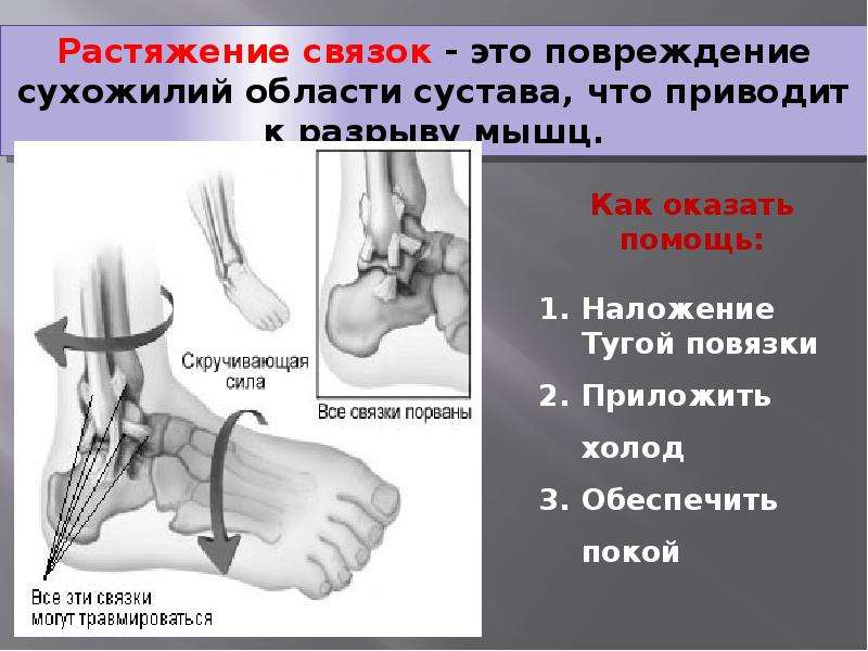 Первая помощь при переломах и вывихах презентация