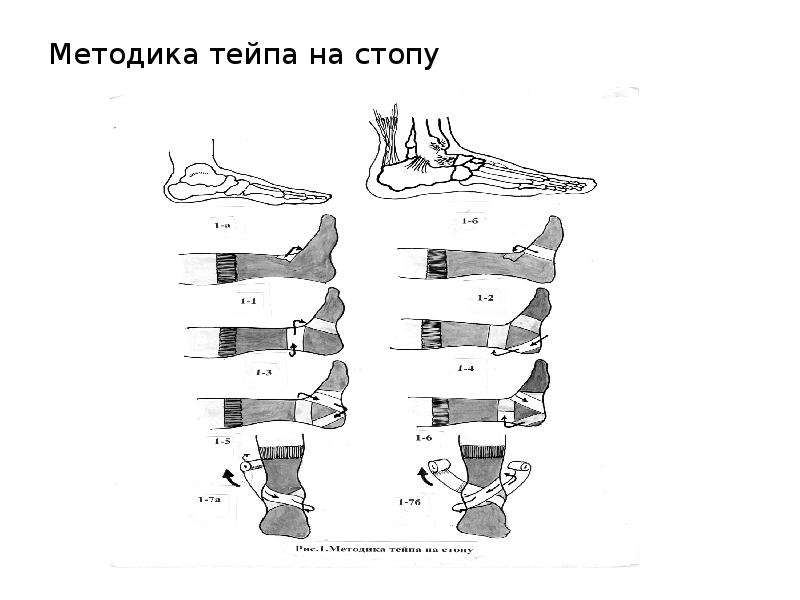 Травмы в волейболе презентация