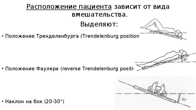 Положение тренделенбурга. Положение пациента тренделенбургу. Положение Тренделенбурга на операционном столе. Положение Тренделенбурга применяется при операциях. Положение Фаулера симса Тренделенбурга.