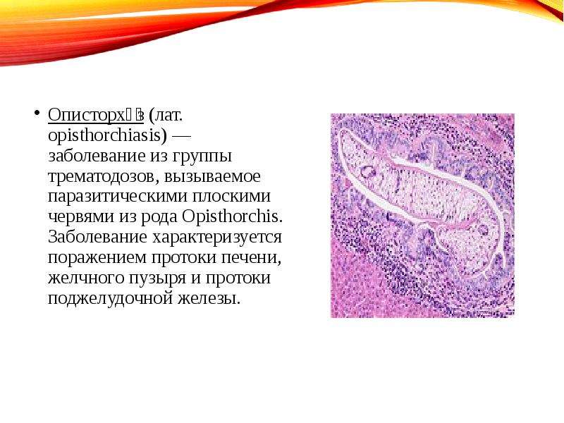 Заболевания поджелудочной железы хирургия презентация