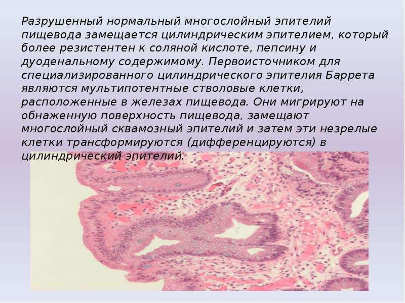 Патоморфологическая картина это