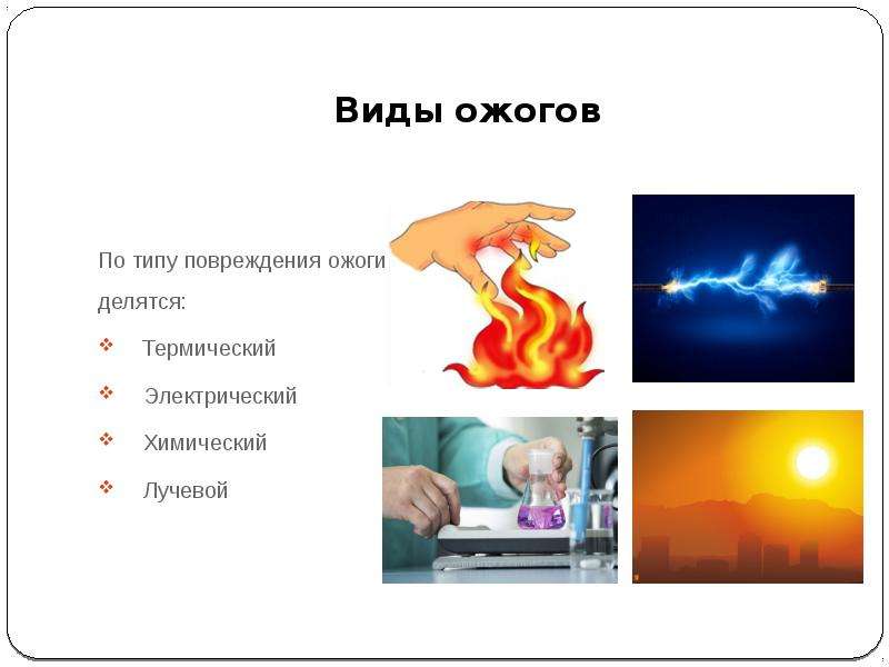 Термические ожоги картинки для презентации