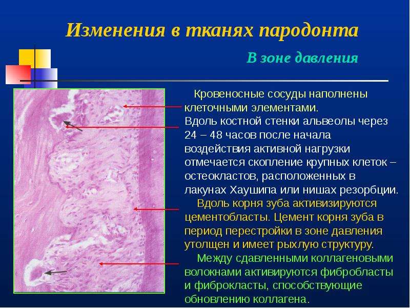 Структурные изменения ткани. Морфологические изменения тканей. Морфологические изменения в околозубных тканях. Изменения в тканях периодонта. Изменения в тканях пародонта.