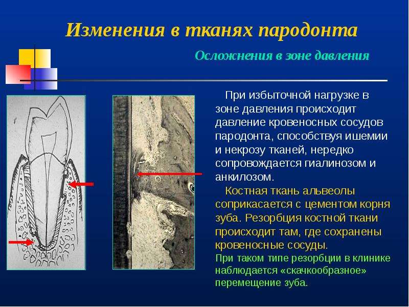 Морфологические изменения. Морфологические изменения пародонта. Изменения в околозубных тканях при ортодонтическом лечении. Структурные и морфологические изменения в тканях зуба. Морфологические изменения в тканях при перемещении зубов..