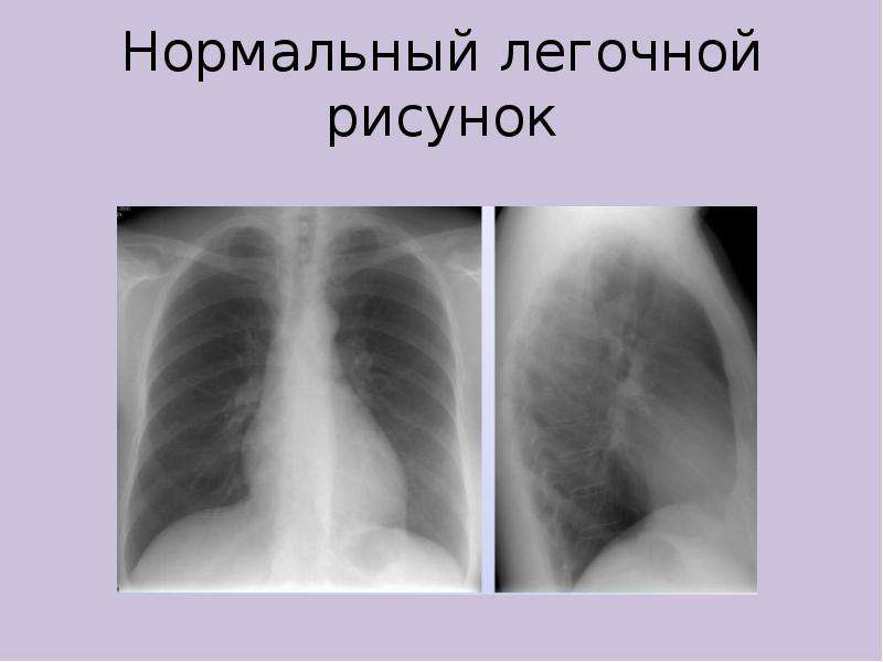 Рисунок деформирован