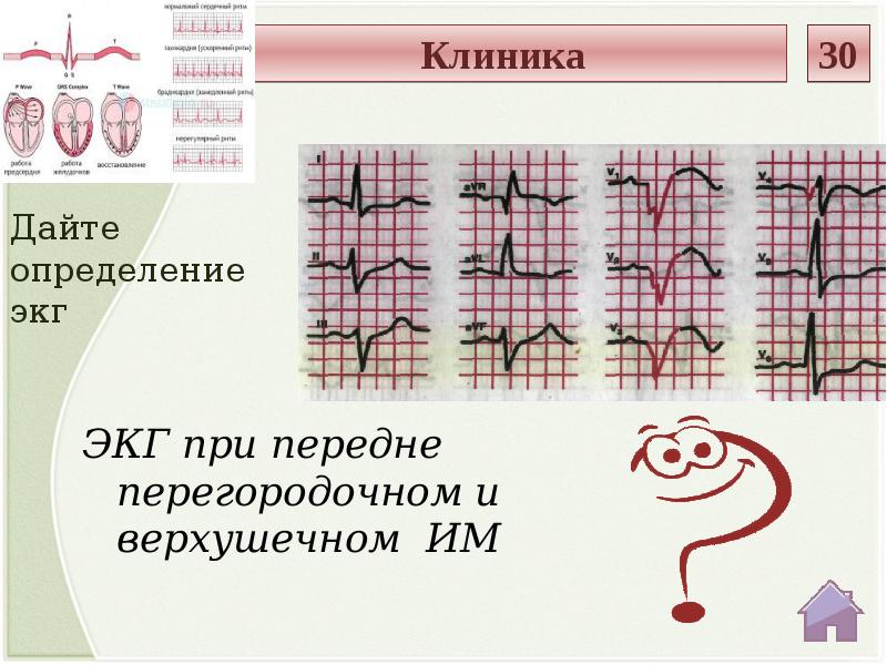 Картинка гадаю по экг