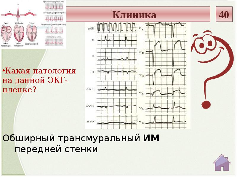 Презентация по экг