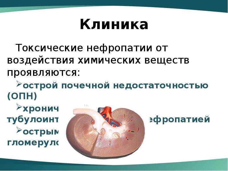 Токсическая нефропатия презентация