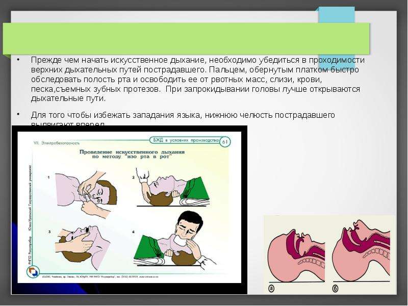 Искусственное начало. Прежде чем начать искусственное дыхание необходимо. При искусственном дыхании необходимо. Прежде чем начать ИВЛ необходимо. Освобождение ротовой полости от рвотных масс.