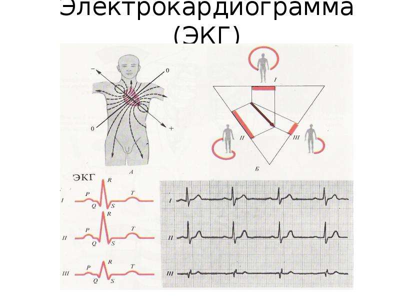 Рисунок экг физиология