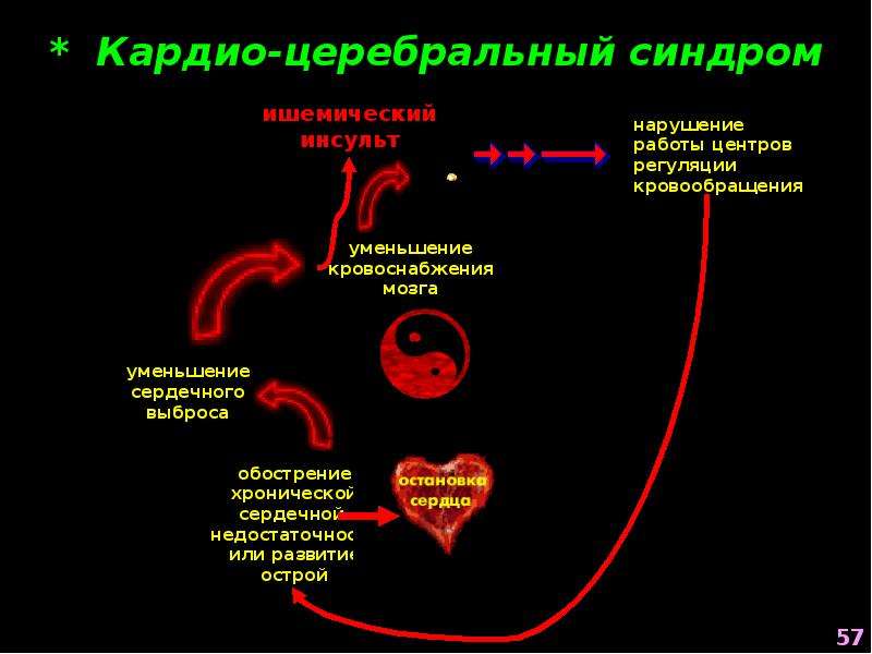 Перегрузка сердца