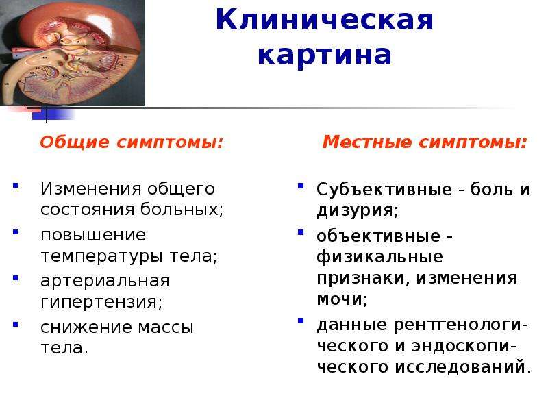 Внелегочный туберкулез презентация