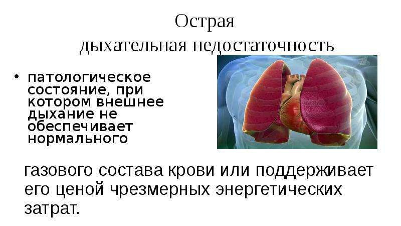 Острая дыхательная недостаточность презентация