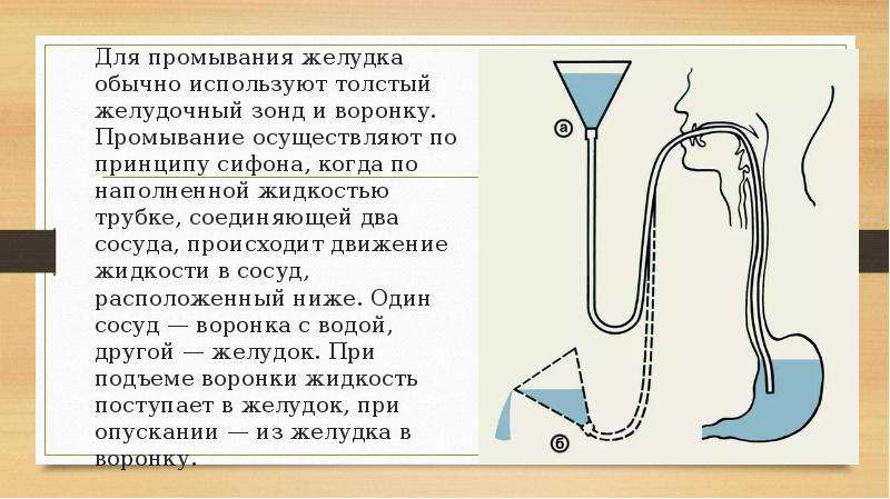 Промывание желудка алгоритм картинки