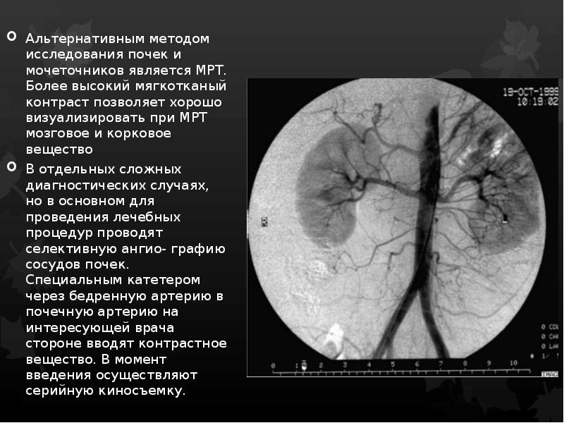 Инструментальные методы исследования почек и мочевыводящих путей презентация