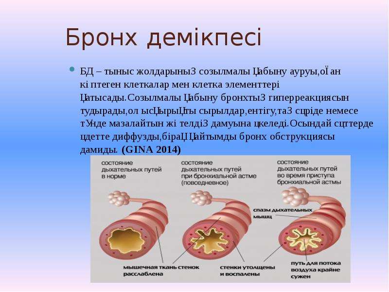 Балалардағы бронх демікпесі презентация