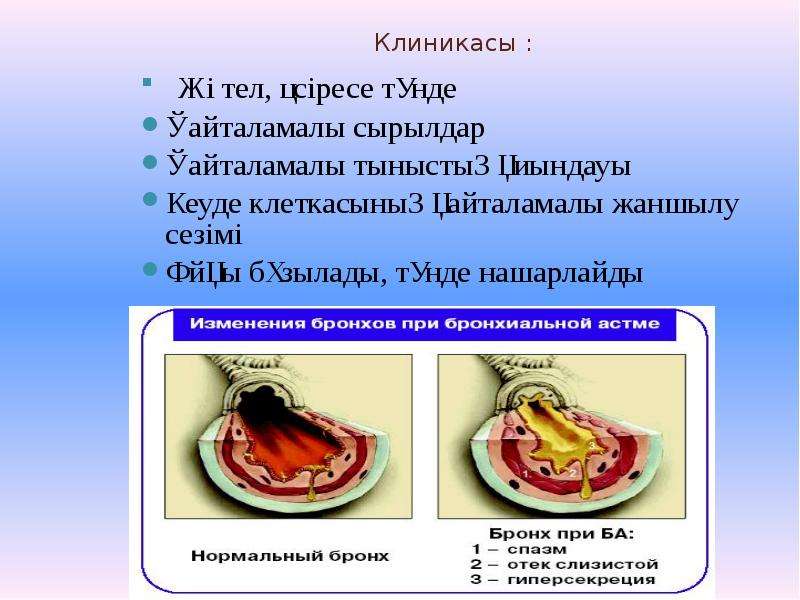 Ларингоспазм карта смп