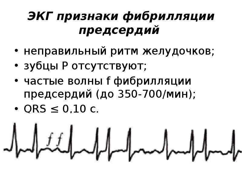 Ритм проводимости