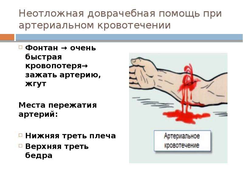 Неотложная доврачебная помощь при артериальном кровотечении Фонтан → очень быстрая кровопотеря→ зажа
