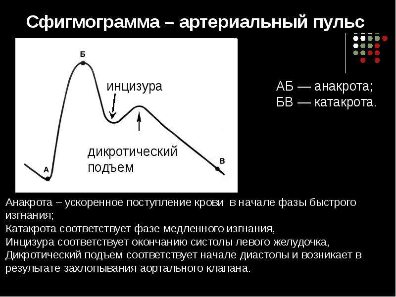 Артериальный пульс. Инцизура сфигмограмма. Сфигмограмма инцизура соответствует. Сфигмограмма пульса. Сфигмограмма физиология фазы.