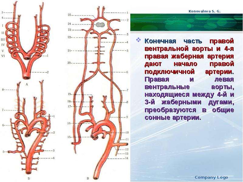 Устье правой подключичной артерии схема