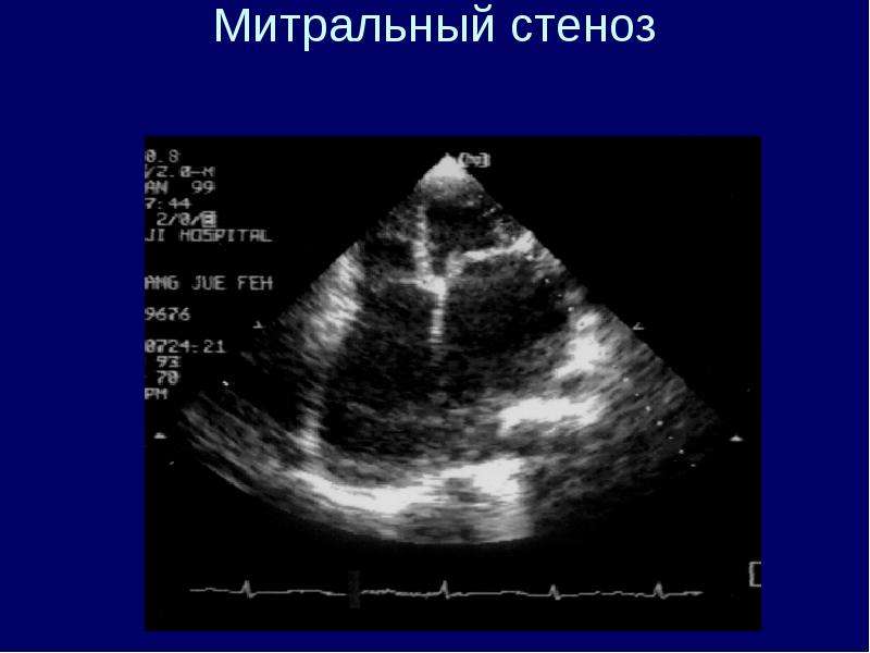 Презентация на тему узи сердца