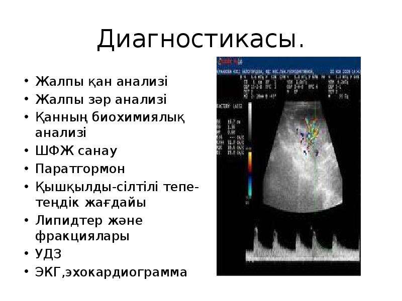 Жалпы зәр анализі презентация